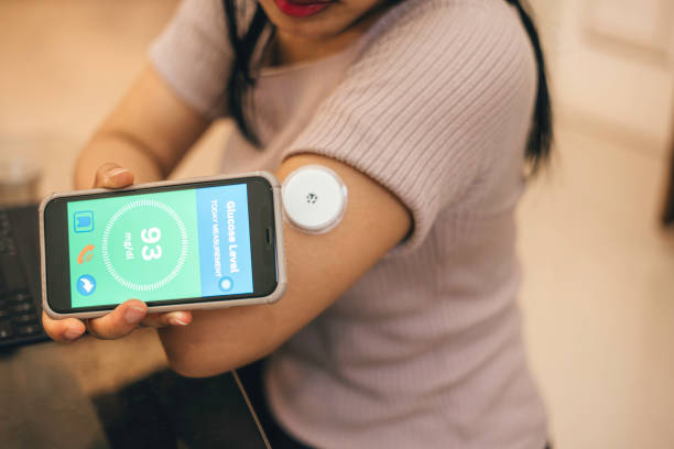 top continuous glucose monitoring companies